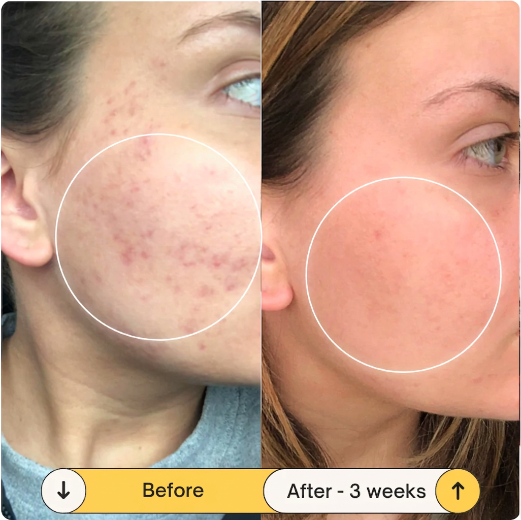 LuminaLift™ Radiance Serum