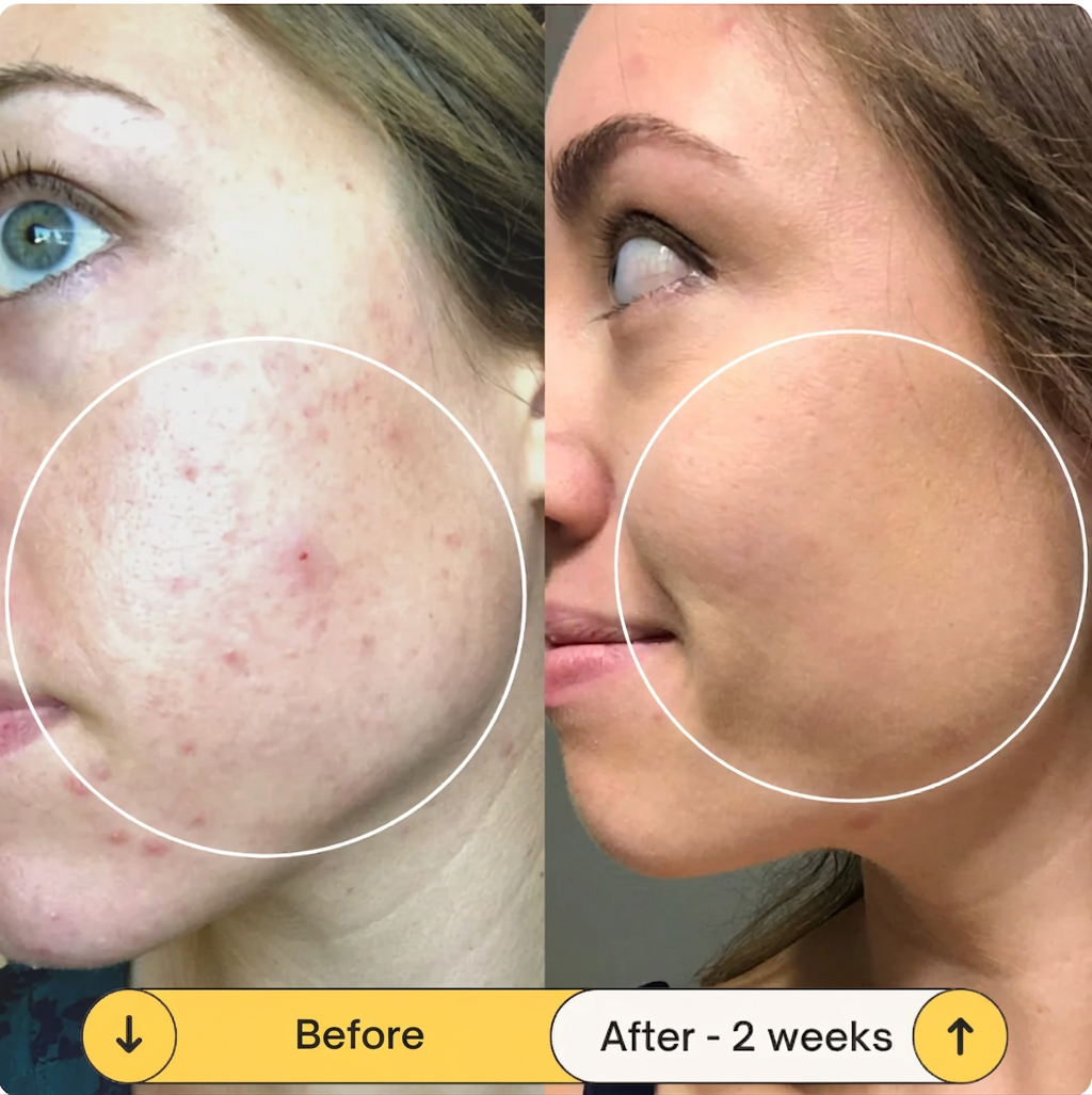 LuminaLift™ Radiance Serum