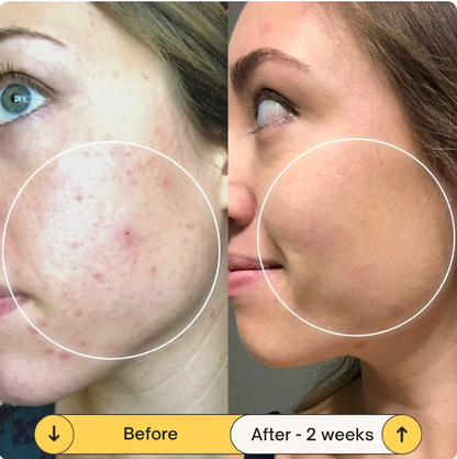 LuminaLift™ Radiance Serum